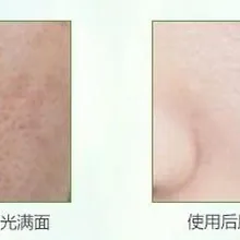 1000 г Осветляющий жасминовое эфирное масло лосьон отбеливающий лосьон для кожи быстрое отбеливание лосьон веснушки