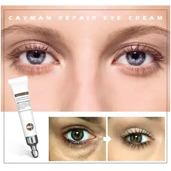 

Remover Dark Circles Against Puffiness Cream Anti-wrinkle Age Eye Cream Hyaluronic Acid Eye Serum