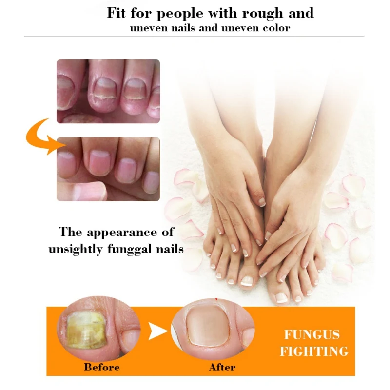 20g Nail Care Tools Anti Toenail Fungus Nails Nourishing Cream Nail Treatment Hand Foot Protector Nails Repair Serum
