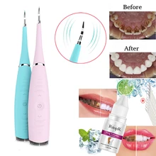 Отбеливание зубов для домашнего использования, звуковой стоматологический скалер для удаления зубных чисел, высокочастотная вибрационная зубная Очищающая машина USB