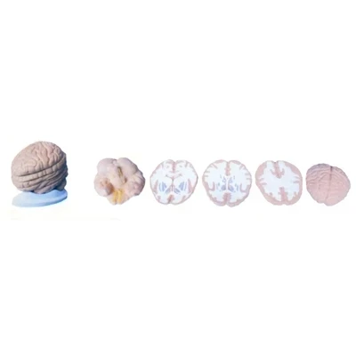 

Brain horizontal cut model Lateral anatomical cutting model of brain Teaching demonstration visual props 17*14*19cm