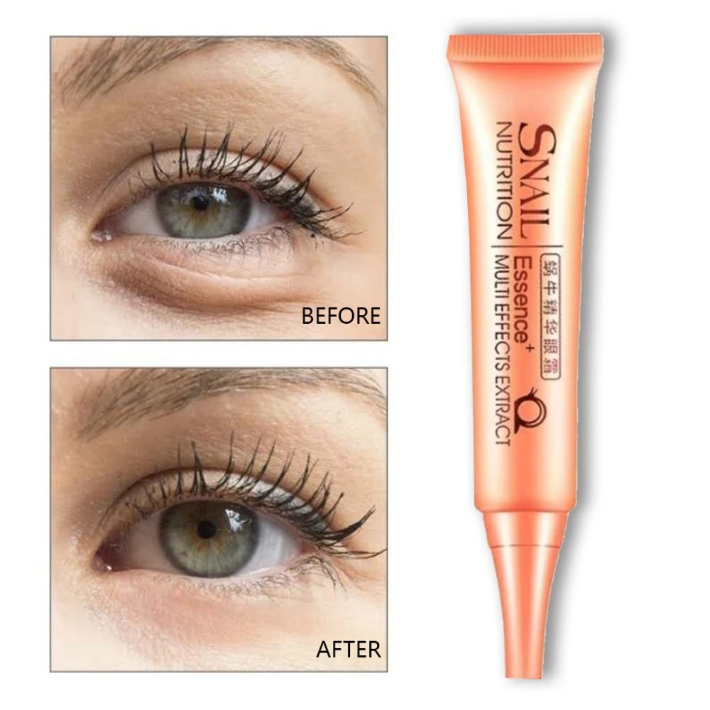 under eye anti wrinkle