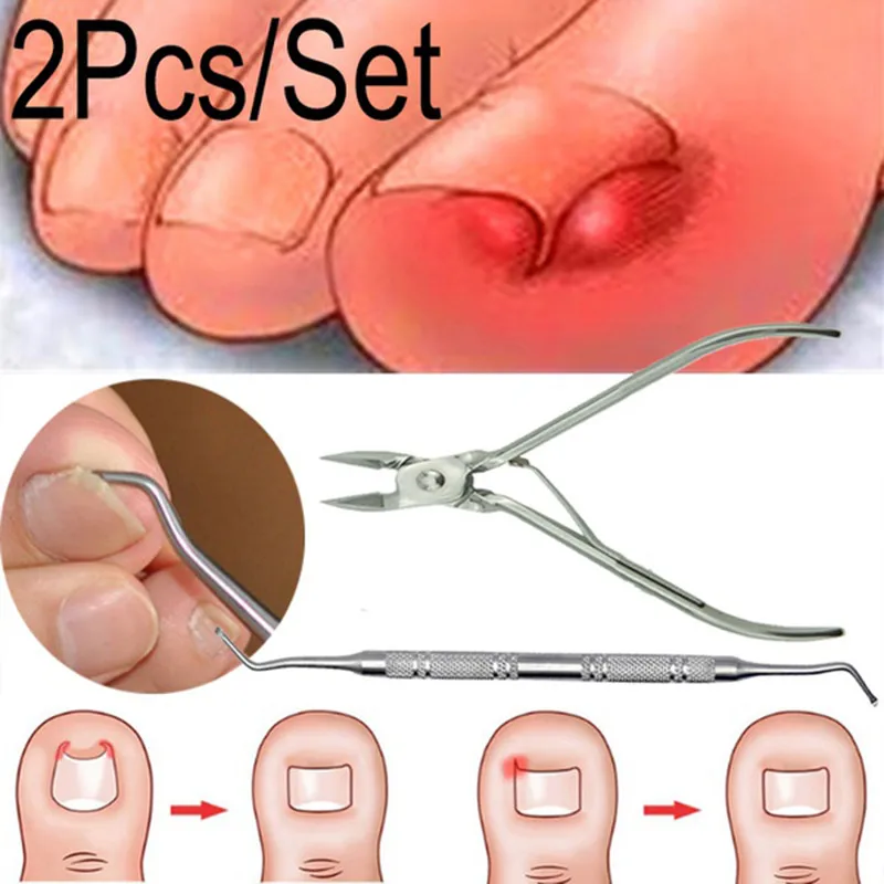 

2Pcs/Set Ingrown Toe Nail Correction Nippers Clipper Cutters Dead Skin Dirt Remover Paronychia Podiatry Pedicure Care Tool