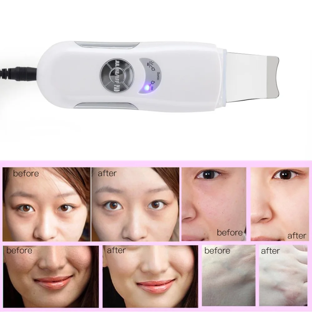 

NEW Ultrasonic Scrubber Cleaner Face Cleaning Acne Removal Facial Spa Massager Ultrasound Vibration Peeling Massage Machine