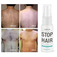 Ингибитор роста волос восстановление кожи лобка гладкое удаление волос на теле лечение мягкий спрей для удаления волос