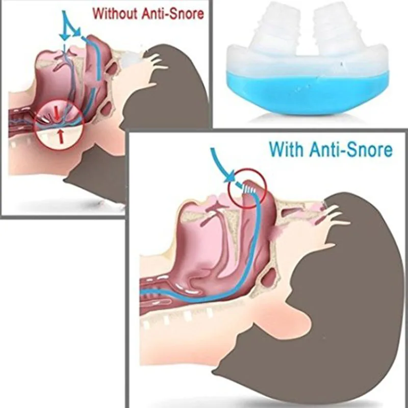 Облегчение храпа в носу, устройство для остановки храпа, дыхательный аппарат, защитное устройство для сна, мини устройство для храпа, антихрап, силиконовый