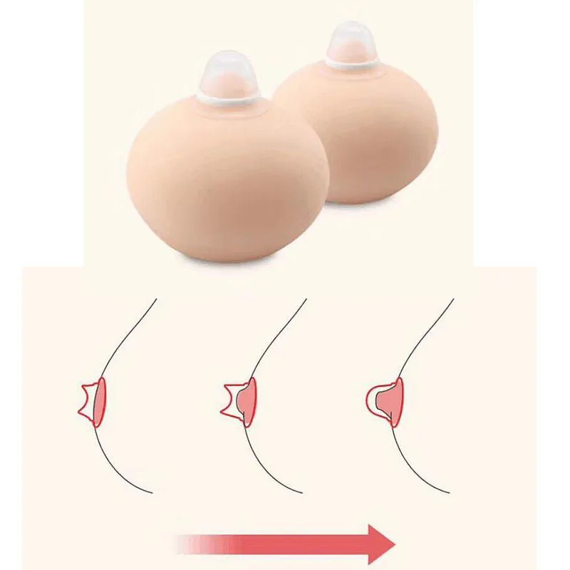 1 пара аспиратор для сосков, съемник для лечения ниплет, коррекция сосков