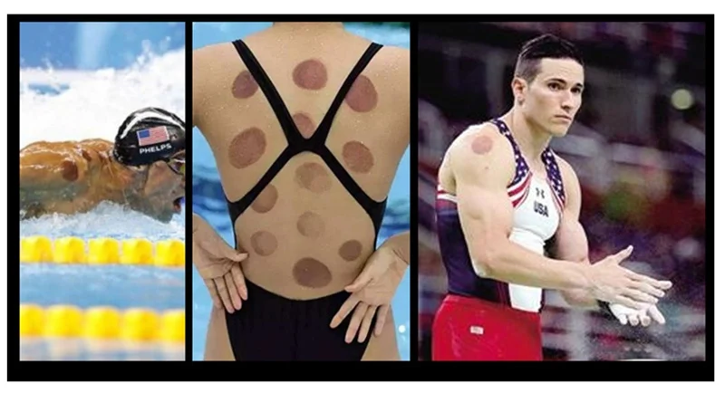 Cupping massage (9)