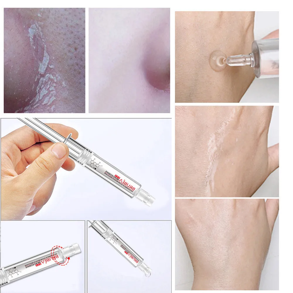 5 мл Гиалуроновая кислота ремонт кожи лица Сыворотка иглы эссенция лица гидратация увлажняющий против морщин Антивозрастной уход за кожей FD