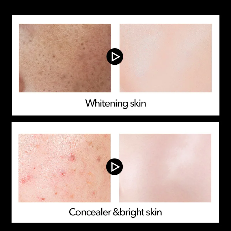 Goedkoop MENCODES 50ml Mannen Nicotinamide Whitening Gezicht Crème Fleuren Huidskleur Up Crème Hydraterende Concealer Whitening Crèmes