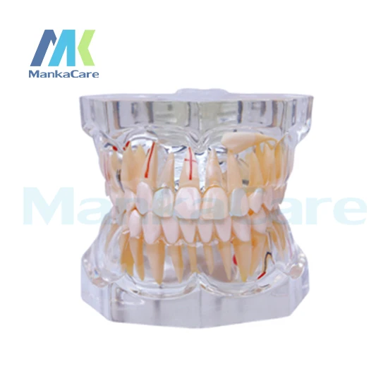 

Manka Care - 2.5 Times Pathology Oral Model Teeth Tooth Model