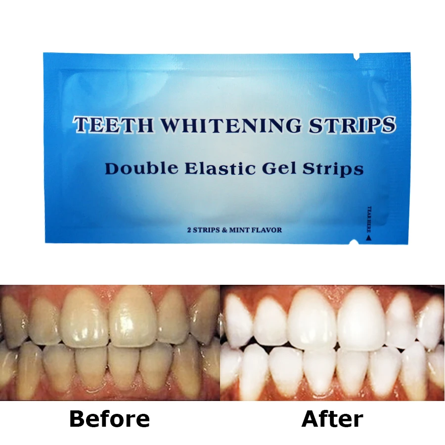 Aliexpress Buy Professional Non Peroxide Teeth Whitening within Teeth Whitening Peroxide