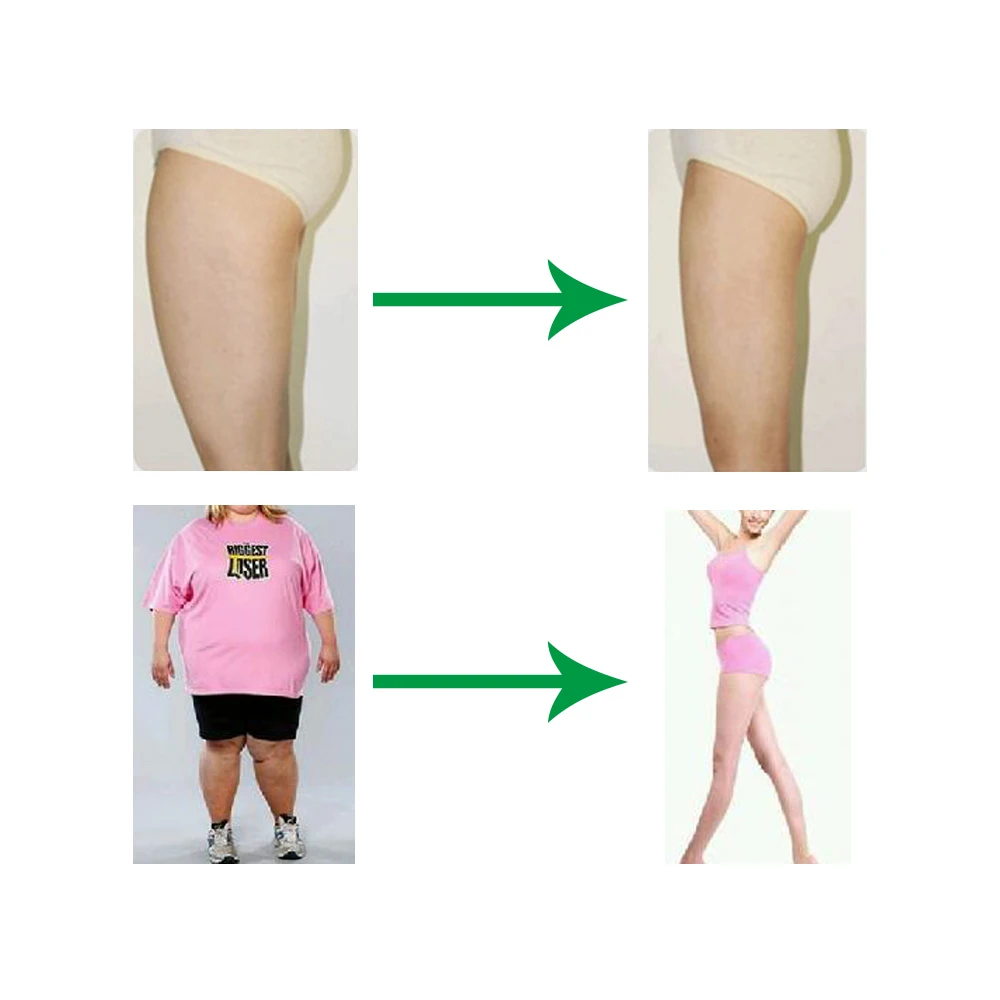 slimming costum gratis soso lipo 6 evenimente de pierdere în greutate recenzii