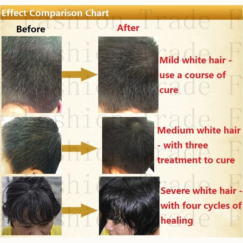 Надежный бренд DSY лечение травами для лечения белых волос Тоник 60 мл экстра-сила делает волосы черными китайской медициной без бокового эффекта