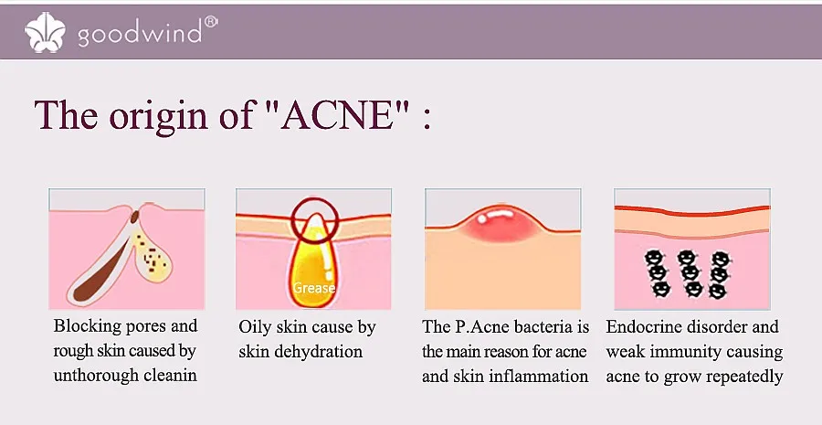 jade face massage roller radio frequency cavitation ultrasonic slimming electronic foot massager ultrasound portable device massage equipments