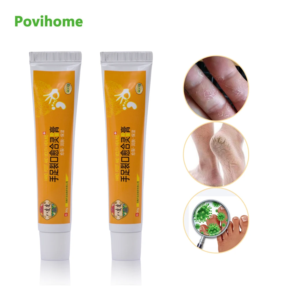 

1 pcs Repair Frostbite Cream Hand Foot Crack Ointment Heel Chapped Peeling Anti Dry Crack Skin Care Medical Plaster 30g P1009