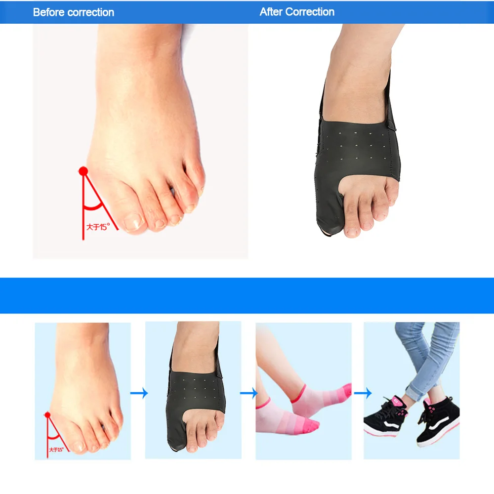 Ультра-тонкий большой корректор бурсита большого пальца стопы вальгусная деформация выпрямитель для ног облегчение боли ортопедии ногу инструмент для ухода унисекс PU эластичное волокно
