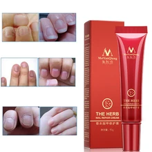 1 шт., MeiYanQiong, высокое качество, защита для ногтей, крем для ухода за кожей, Лечение грибка ногтей, травяные ногти, восстанавливающий крем, инструменты для ухода за ногтями, 15 г