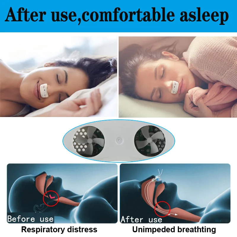 CPAP nose stop breathing (4)