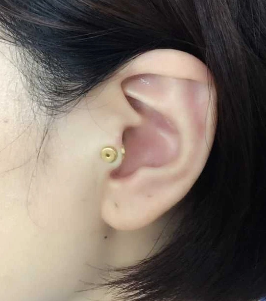 1 set Magnet Ear Therapy Biomagnetic Reducing Weight and Appetite Without Diet Slimming Health Massage Care