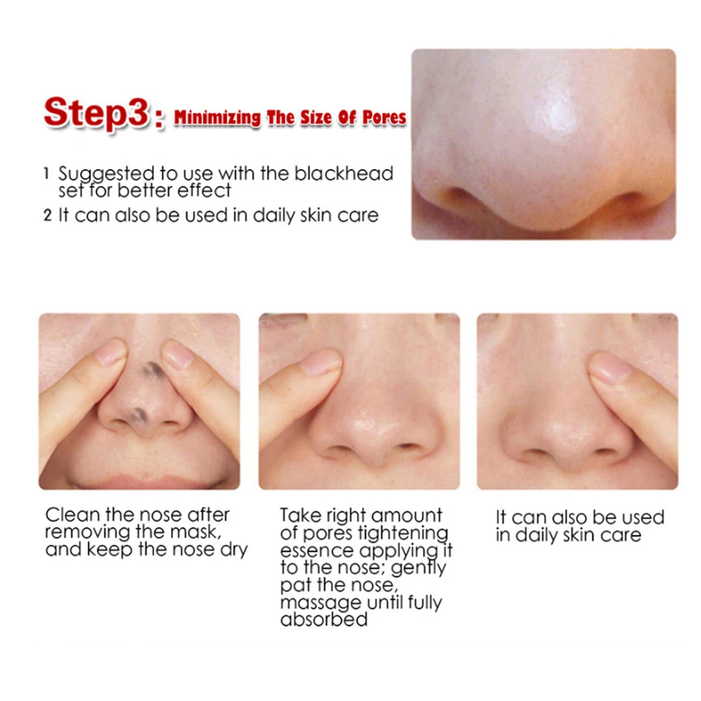 Essence Liquid Blackheads Removal Mask Nasal Membrane Blackhead Remover Strength Fast Fashion Suction Black Head