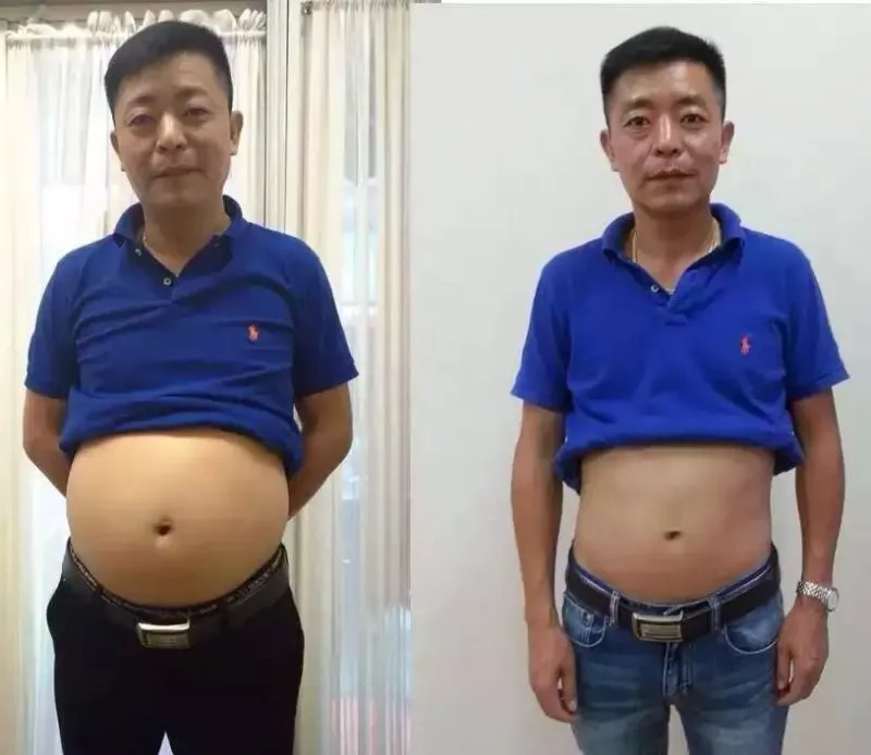 weight loss products patch minceur emagrecimento queimar gordura fat dieet parches adelgazantes afvallen slim patch for slimming