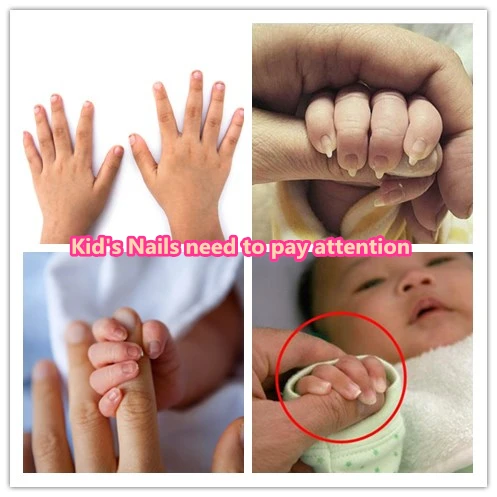 kid's nails need attention