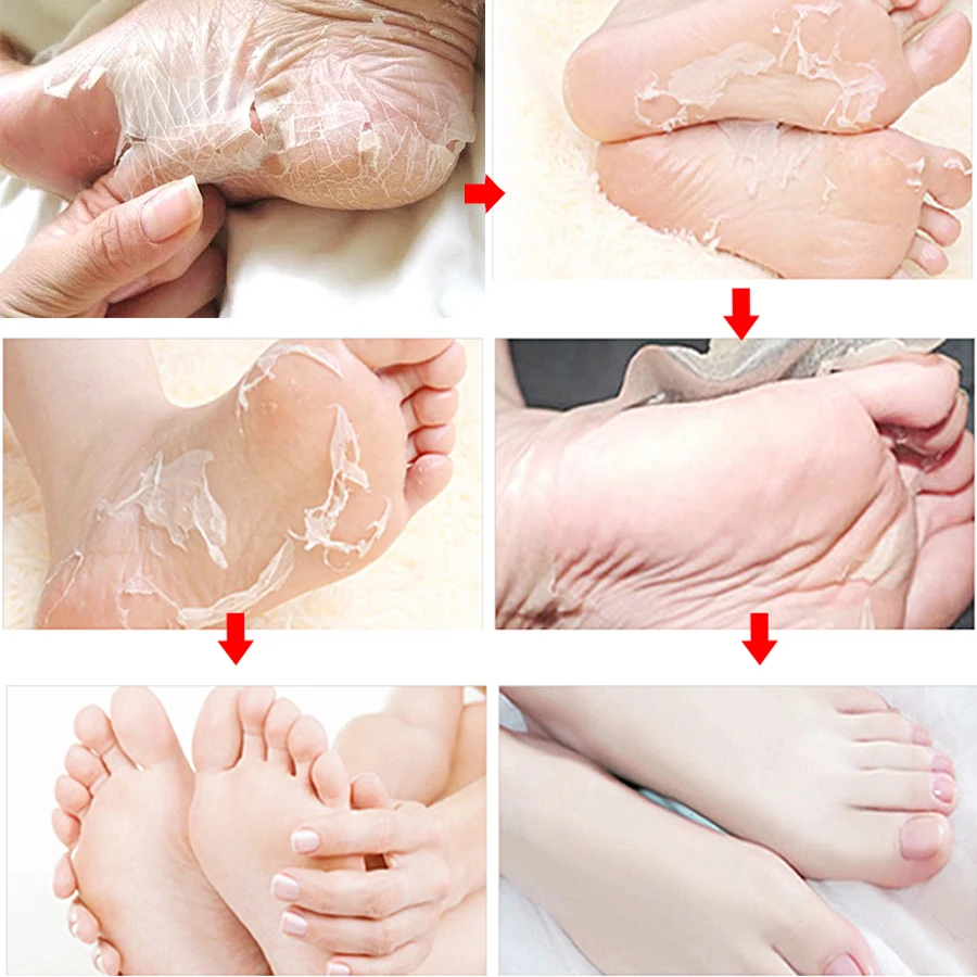 4Pcs=2pack Exfoliating Foot Mask Pedicure Socks Exfoliation for Feet Mask for Leg Remove Dead Skin Peeling Lavender Foot Masks 4Pcs=2pack Exfoliating Foot Mask Pedicure Socks Exfoliation for Feet Mask for Leg Remove Dead Skin Peeling Lavender Foot Masks