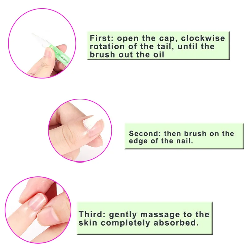 Китайская травяная мазь для лечения грибка ногтей|fungus treatment|nail fungus treatmentnail treatment |