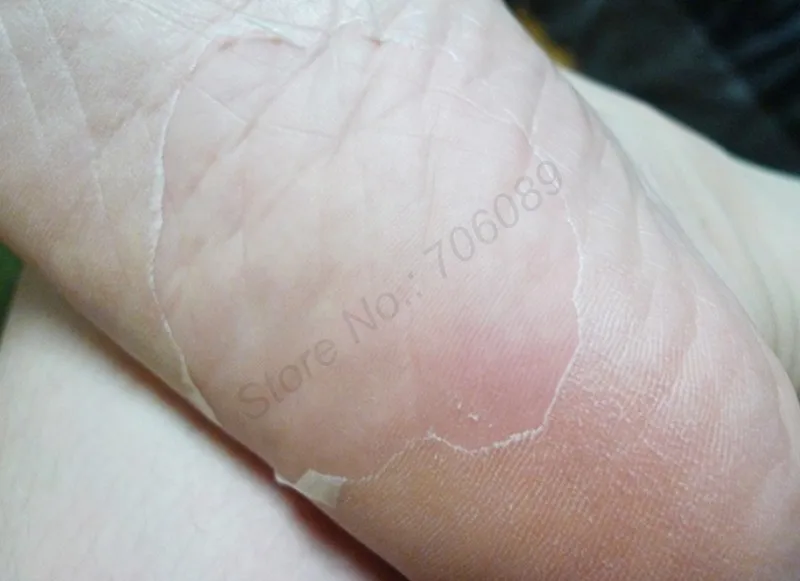 conew_new skin vs old skin[1]