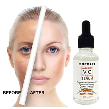 

Vitamin C Serum VC Removing Dark Spots Freckle Speckle Fade Ageless Skin Care Whitening Face Anti Winkles Essence Beauty