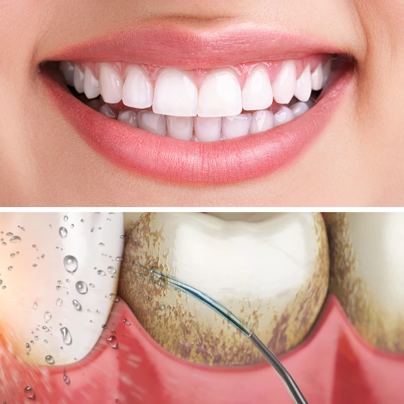 Профессиональный пероральный перезаряжаемый портативный стоматологический ирригатор для чистки зубов полости рта зубная нить водоструйный ирригатор изысканный