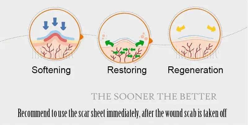 Self-adhesive-silicone-scar-paste(12)