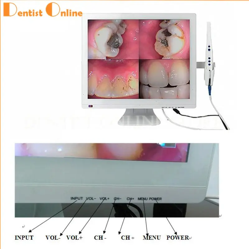 Зубные Интраоральной Камера m-978(2 в 1)+ Автономное 17 дюймов светодиодный Мониторы полости рта Камера