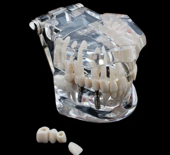 

Anatomical Medical traumatic pistol Human anatomy traumatism Professional Magnified Pulmonary Alveoli Joint Simulation