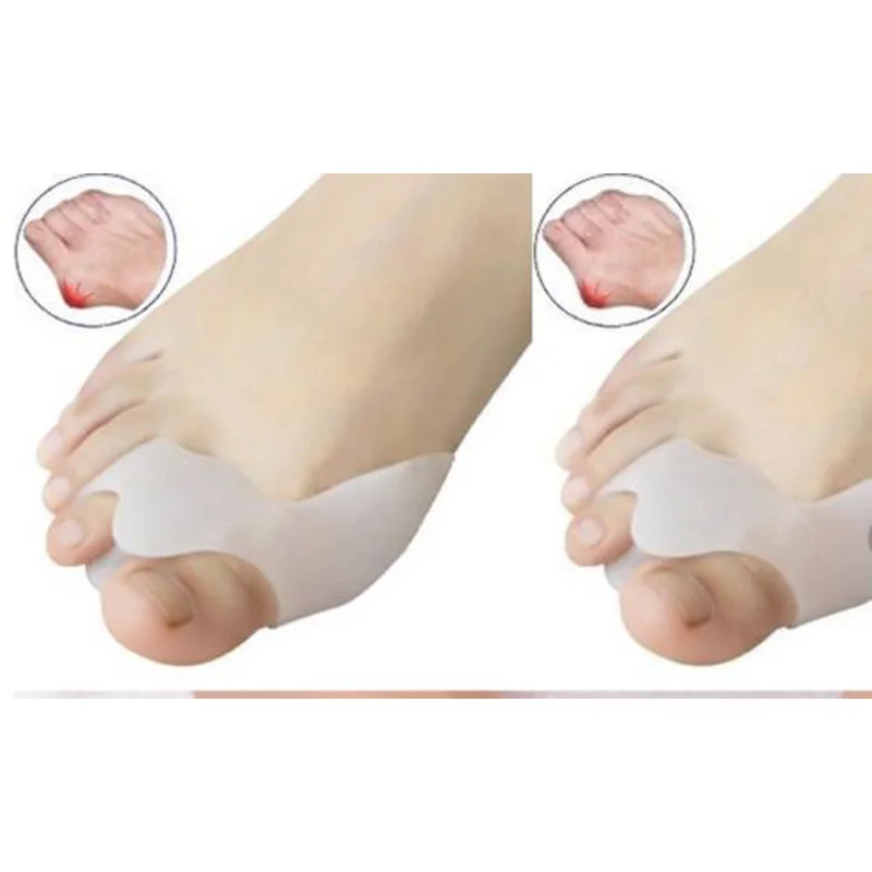 Genuine Special Hallux Valgus Pro Bicyclic Bone Orthotics Braces Toe Separator Pedicure Corrector Protector Bunion Adjuster