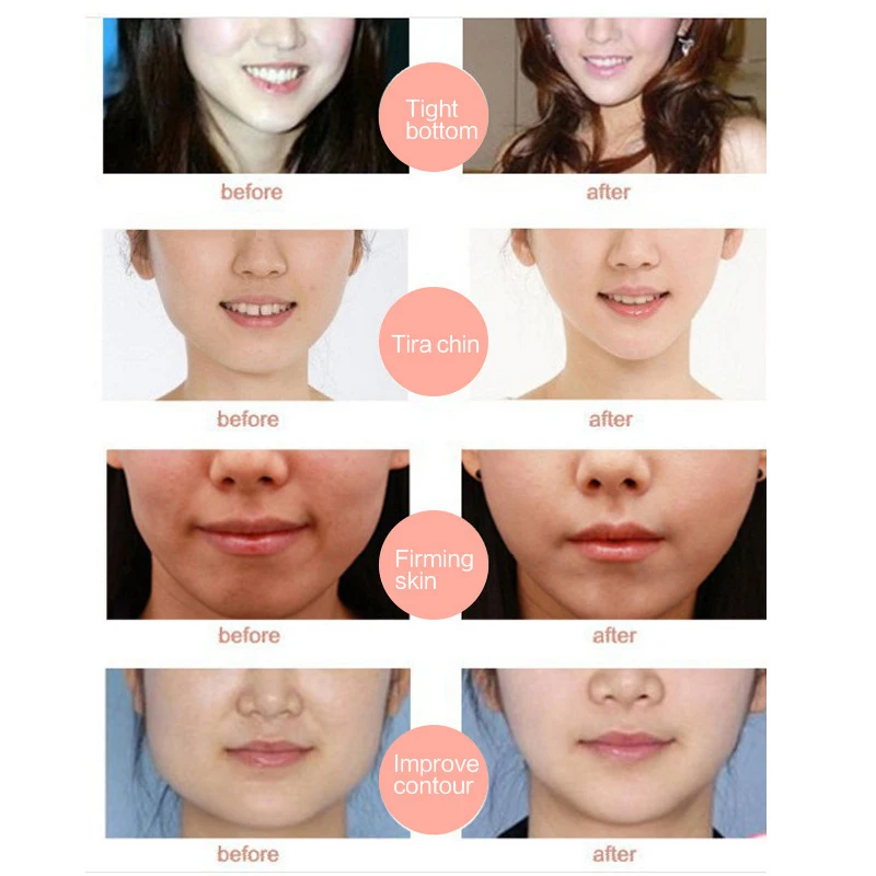 EFERO лифтинговые маски для лица V shape Face Slim Check шейный Лифтинг Маска V shape r для похудения лица повязка для ухода за кожей TSLM1