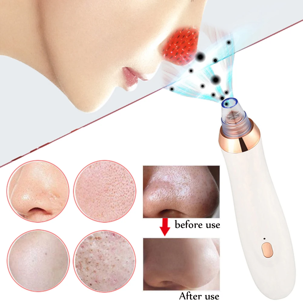 Beli Perawatan Kulit Pori Vacuum Komedo Remover Jerawat Jerawat Penghapusan Vakum Pori Cleaner Minyak Kutikula Menghapus Facial Komedo Extractor