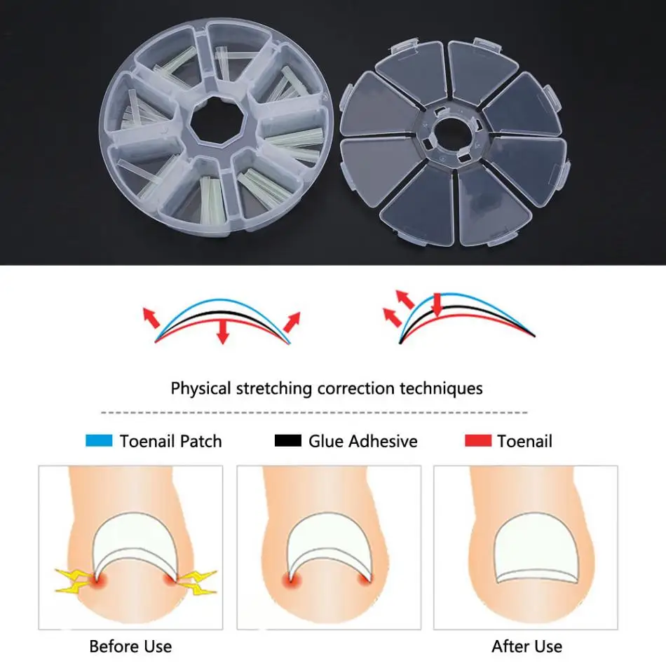 

120pcs/box Ingrown Toenail Straightening Clip Sticker Brace Toenails Thick Paronychia Acronyx Correction Patch Foot Care Tool