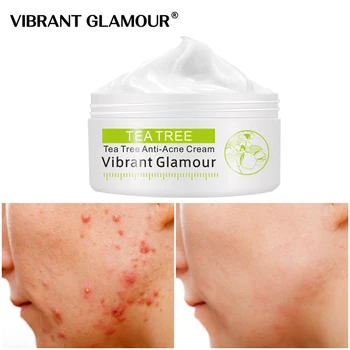 

VIBRANT GLAMOUR Tea Tree Face Cream Anti-Acne Shrink Pores Oil Control Treatment Acne Scar Pimples Whitening Nourish Skin Care