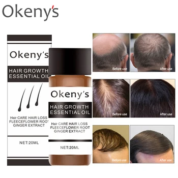 

20ml Yuda Pilatory andrea hair growth products ginger oil hair growth oil Shampoo Anti Gray Loss Liquid Repair Growing Faster