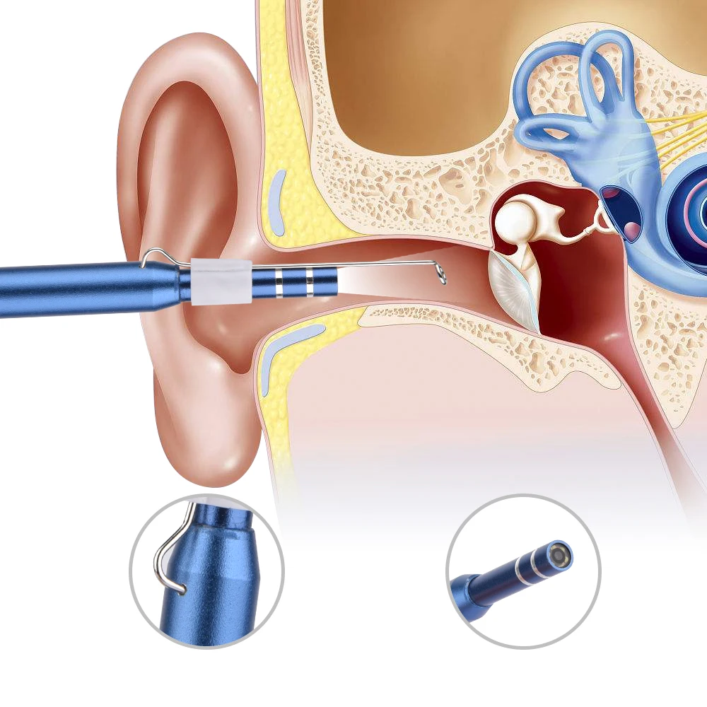 Эндоскоп для чистки ушей 2 в 1 USB HD визуальная Ушная ложка 5,5 мм мини-камера Android PC ушной отоскоп бороскоп инструмент для ухода за здоровьем
