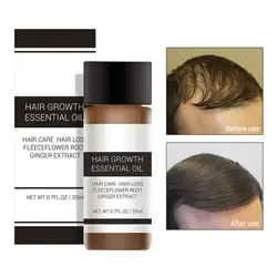 Для мужчин быстрый мощный роста волос товары эссенция продукты предотвращают выпадение волос эфирное масло жидкость для лечения мужчин t 20