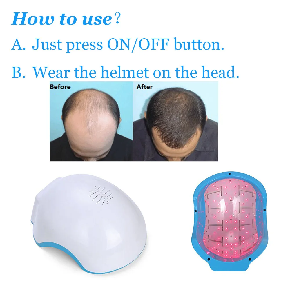 COZINGLaser Helmet 80pas laserMedical Diodes Treatment Hair Loss Solution Hair Fast Regrowth  Laser Caphair caps for women hair 