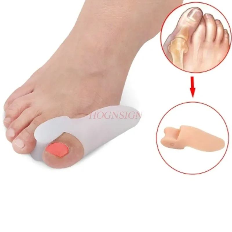 

Thumb valgus toe aligner to correct orthosis big foot bones toe head men and women wear shoes day and night