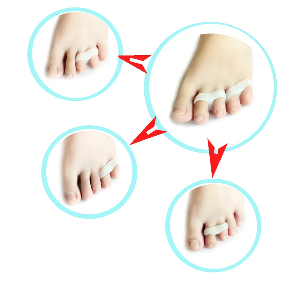 3 пары Детская Силиконовая защита для большого пальца ноги|finger toe separator|toe separatorbunion