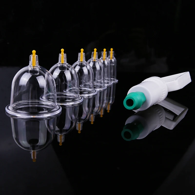 cupping (2)