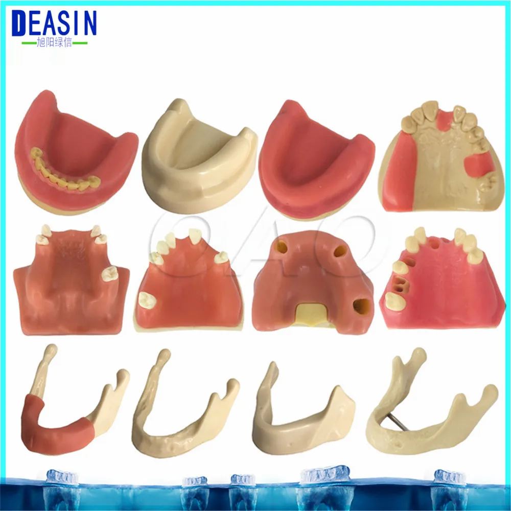 Высокое качество для тренировки имплантации модель для обучения зубной зубы стоматолог анатомический анатомия Стоматологическая модель
