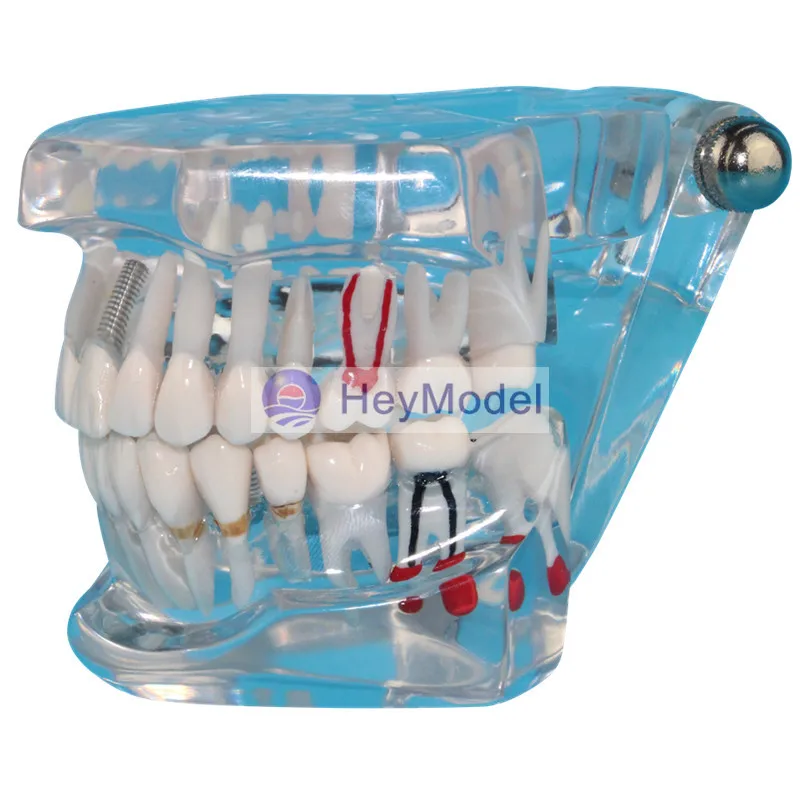 Heymodel Прозрачные зубы ремонт модель реальный размер 1:1