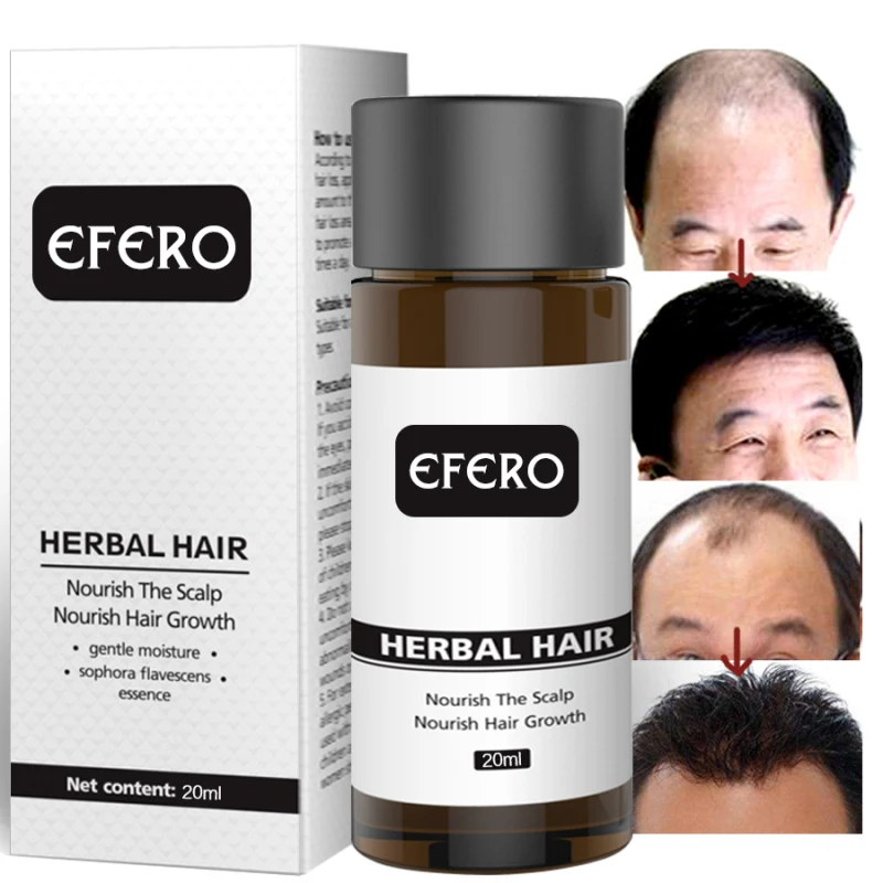 20 мл быстрая мощная эссенция для роста волос имбиря продукты для выпадения волос для роста волос масло для роста бороды Эфирное забота о здоровье TSLM1